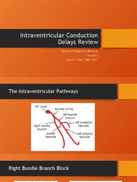 Intraventricular Conduction Delays Review | PDF | Electrocardiography ...