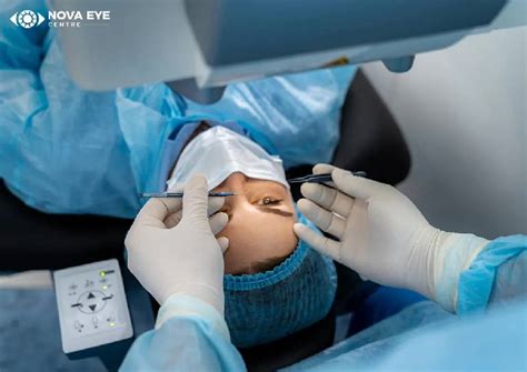 Types of Laser Eye Surgery | Nova Eye Centre