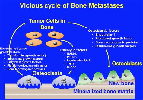 Pin on Prostate cancer