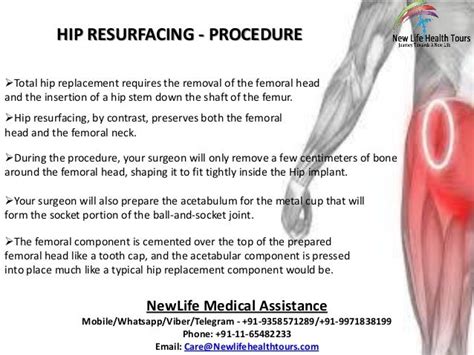 Hip Resurfacing Surgery in India