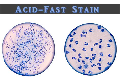 Ex 9 - Acid-Fast Stain - SCIENTIST CINDY