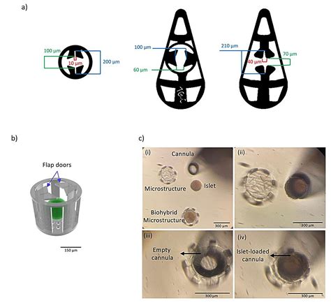 Eye implant may be used to treat diabetes and other diseases