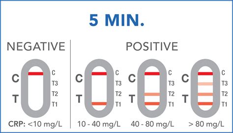 C-Reactive Protein Test | PRIMA Lab SA