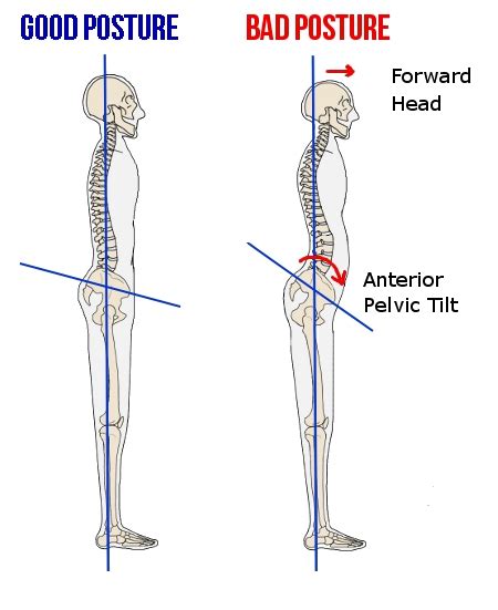 Anterior Pelvic Tilt. Training Talk. - Organic Runner Mom