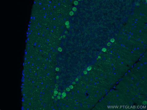 Calbindin-D28k antibody (66394-1-Ig) | Proteintech