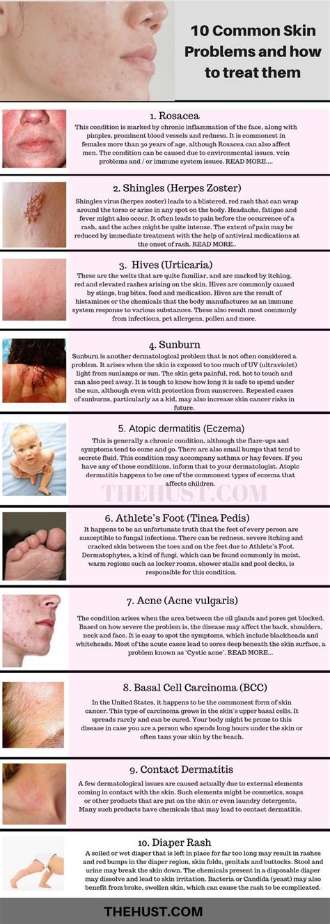 10 common skin conditions and problems: Pictures and treatments | Skin problems, Skin allergies ...