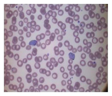 Different types of malaria peripheral blood smear images (a) P.... | Download Scientific Diagram