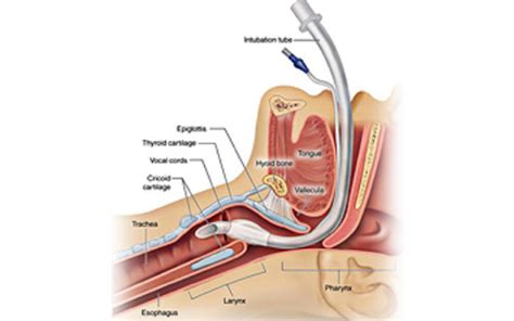 EGENT Center for Ear, Nose & Throat - Services- Vocal cord surgery