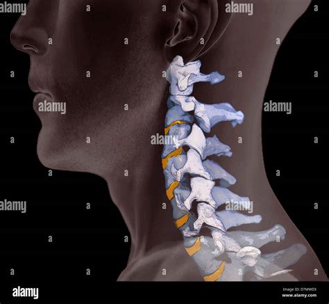 Normal neck bones, 3D CT scan Stock Photo, Royalty Free Image: 56392703 - Alamy