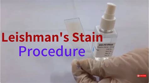 Leishman's Stain Procedure-In English - YouTube