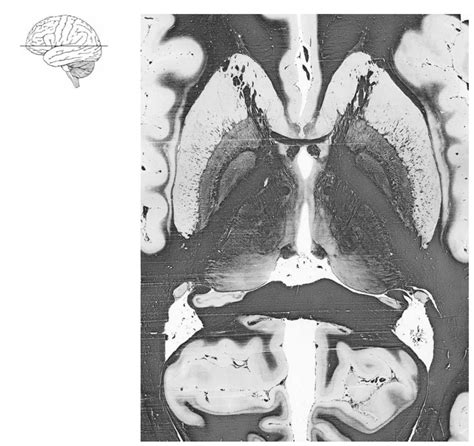 Horizontal myelin-stained section through the cerebral hemisphere at the level of the thalamus ...