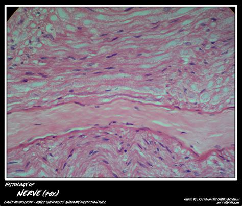 Histology: Nerve Fibers - My Aimst University Lifestyle Blog