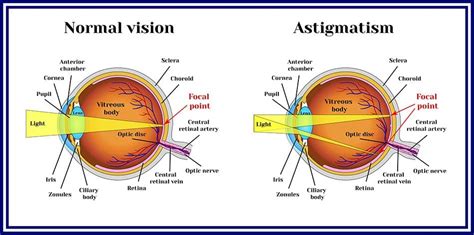 The Best Contact Lenses in 2022: How to Choose | NVISION Eye Centers