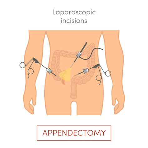 Recovery from Surgery - CLASSICALLYPRACTICAL.COM