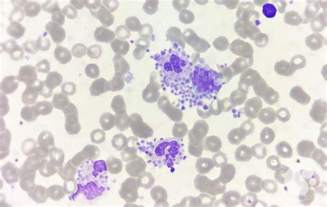 Platelet satellitism around leucocytes 1