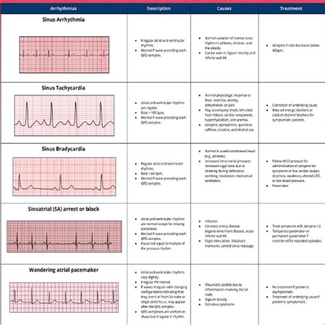 Basic EKG interpretation 3 pages long, printable pdf, immediate ...