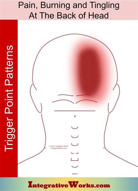 Pain, Burning & Tingling on Back of Head Cervicogenic Headache ...