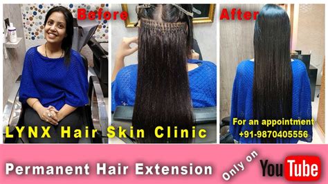 Before and After | permanent Hair Extensions | +91-9870405556 - YouTube