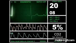 Hospital Monitor with FlatLine (L) (HD) on Make a GIF