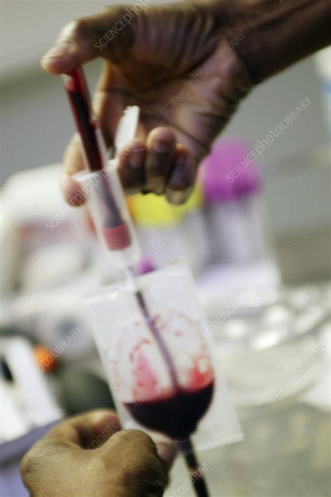 Blood sampling - Stock Image - M532/0709 - Science Photo Library