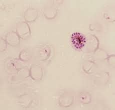 Microsporidia Infection