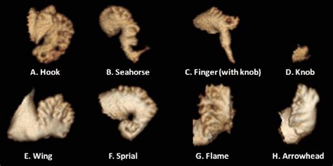 Left Atrial Appendage Morphology Types