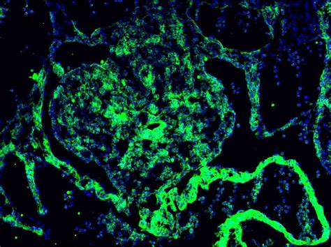 Human DLL4 Antibody MAB1506: R&D Systems