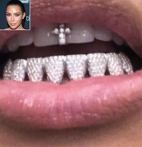 Kanye West Diamond Teeth