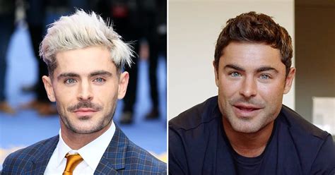 Did Zac Efron Get A Plastic Surgery For His Jaw Before After Look | otakukart