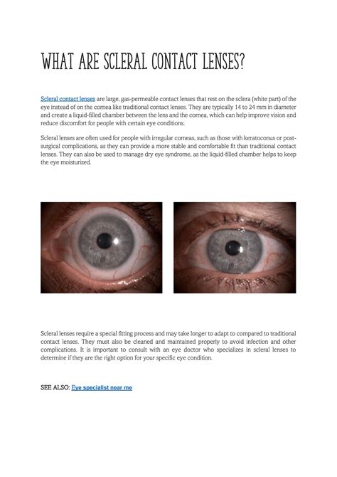 10 Do's & 10 Don'ts of scleral lenses by Global Eye Store - Issuu