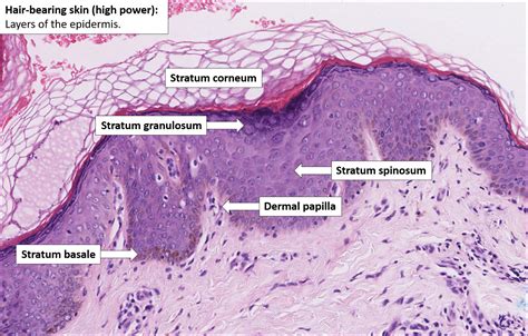 Skin Melanocytes Histology Dermis Epidermis Skin - vrogue.co