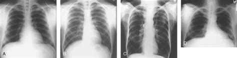 GENERAL ANATOMY AND RADIOGRAPHIC POSITIONING TERMINOLOGY | Radiology Key