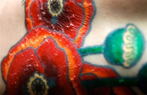 Tattoo Scabbing - How Much Is Normal and What Should You Do?