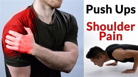 Shoulder Pain During Push Ups – Lance Goyke