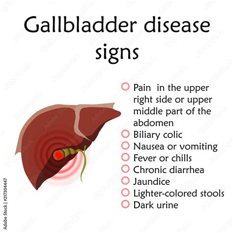 Inflamed Gallbladder Symptoms