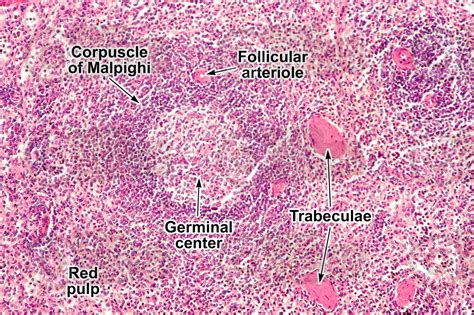 Man. Spleen. Transverse section. 125X - Man - Mammals - Lymphatic system - Other systems ...