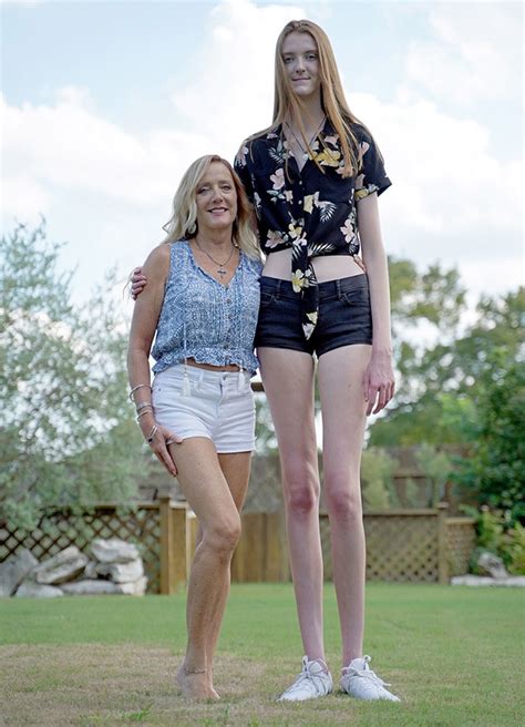 17-Year-Old Aspiring Model Breaks Record For Longest Legs In The World