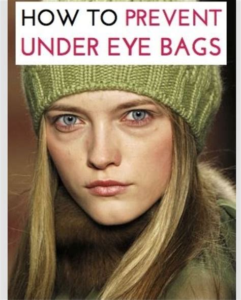 ️ How To Prevent Under Eye Bags ️ | Under eye bags, Eye bags, Natural beauty tips