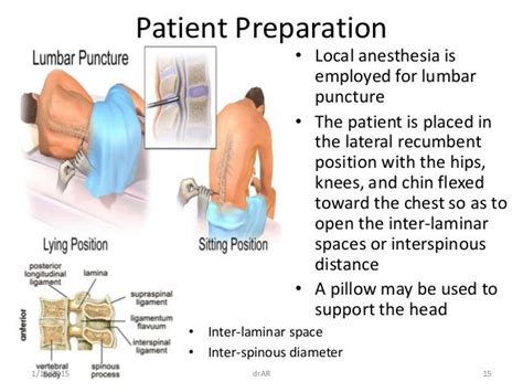 Lumbar puncture