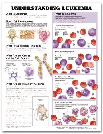 Leukemia Chart - Understanding Leukemia