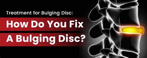 Understanding Bulging Disc – Serene Living Co