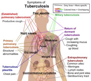 Bacterial Infections - Physiopedia