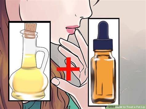 How to Treat a Fat Lip: 14 Steps (with Pictures) - wikiHow