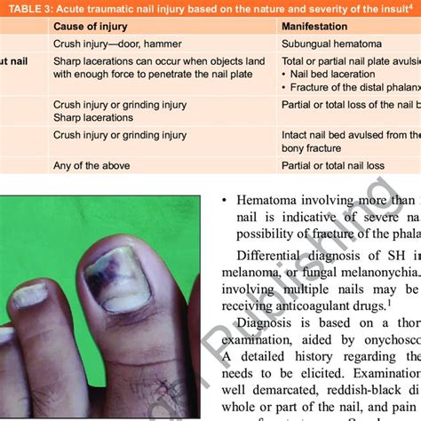 hematoma nail bed icd 10 - zycienitmalowane