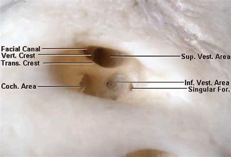 Internal Acoustic Canal