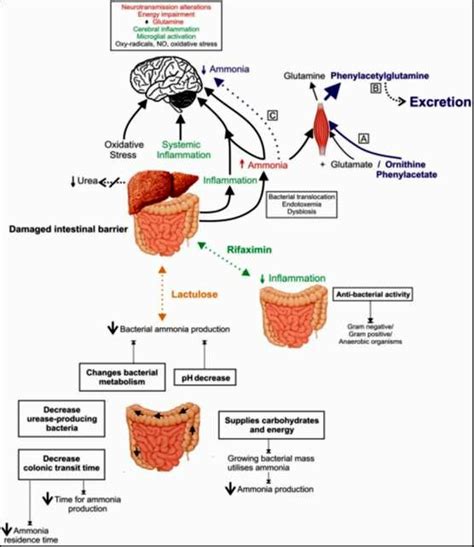 Hepatic encephalopathy mechanisms [7]. | Download Scientific Diagram