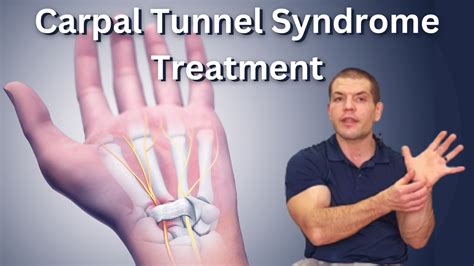 Carpal Tunnel Syndrome Treatment | Avoid Carpal Tunnel Surgery