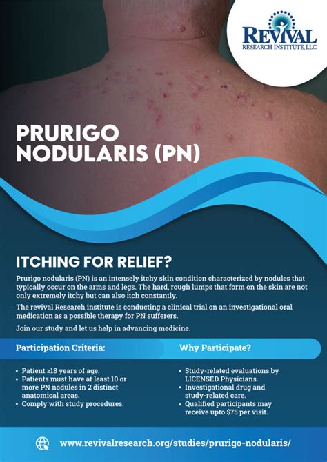 Prurigo Nodularis Clinical Trials