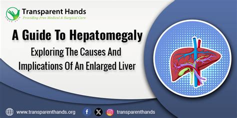 A Guide to Hepatomegaly: The Causes of an Enlarged Liver