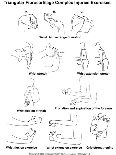 Sports Medicine Advisor 2003.1: Triangular Fibrocartilage Complex ...